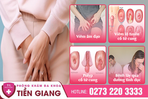 Ra Dịch Đen Kéo Dài Ở Nữ Giới Cảnh Báo Điều Gì?