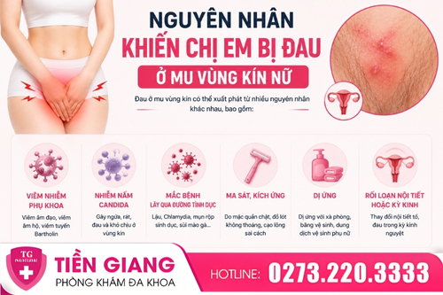 Nguyên nhân gây đau mu ở vùng kín nữ.
