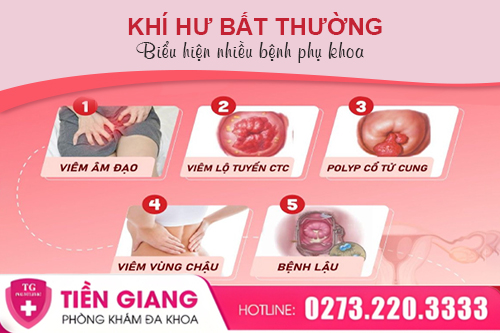 Khí Hư Có Màu Bất Thường Là Dấu Hiệu Gì? Hướng Xử Lý Hiệu Quả