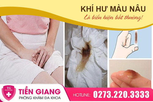 Hoang Mang Khi Thấy Khí Hư Màu Nâu - Dấu Hiệu Cảnh Báo Bệnh Gì?