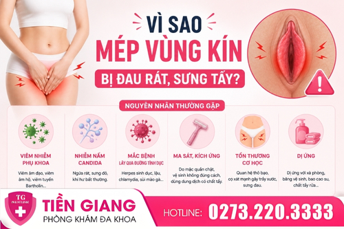 Nguyên nhân khiến mép vùng kín bị đau rát.