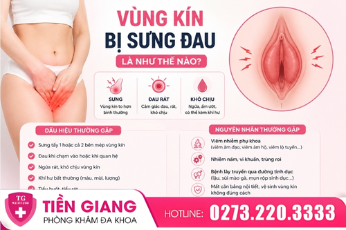 Mu vùng kín bị sưng là như thế nào?