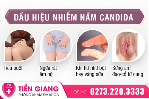 Dấu hiệu nhiễm nấm Candida vùng kín ở nữ.