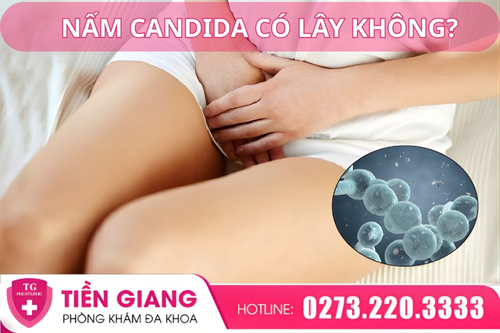Nấm Candida có lây không?