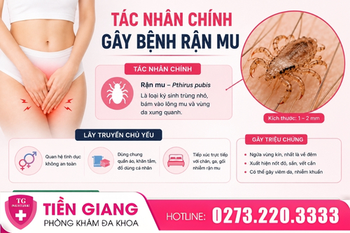 Nguyên nhân gây bệnh rận mu.