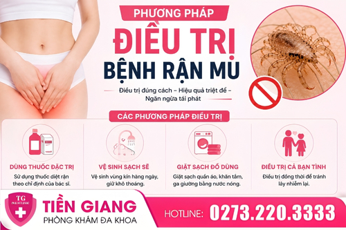 Phương pháp điều trị bệnh rận mu.