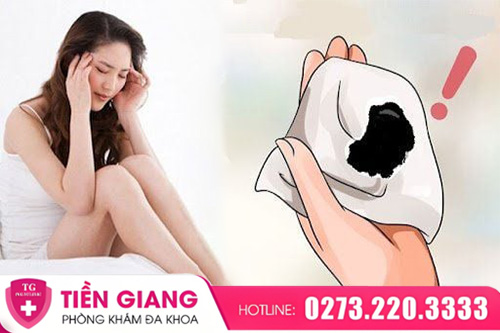 Ra Dịch Đen Kéo Dài Ở Nữ Giới Cảnh Báo Điều Gì?