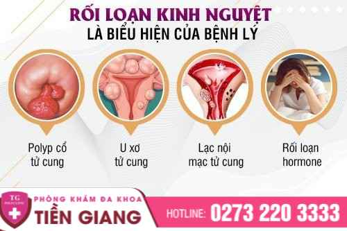 Những nguyên nhân bệnh lý gây rối loạn kinh nguyệt.