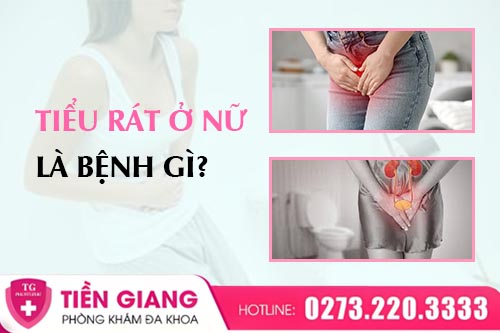 Đi Tiểu Rát Nhiều Ngày Là Bệnh Gì? Nhận Biết Sớm Điều Trị Kịp Thời