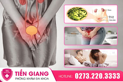 Viêm Bàng Quang Ở Nữ: Khi Nào Cần Điều Trị Sớm