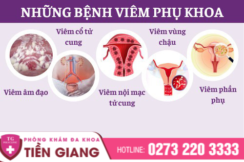 Những bệnh lý gây viêm phụ khoa.