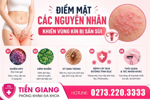 Nguyên nhân khiến vùng kín bị sần sùi.